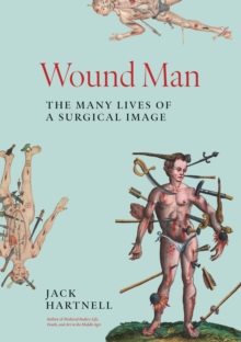 Wound Man