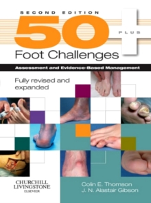 Image for 50+ foot challenges: assessment and evidence-based management