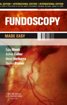 Image for Fundoscopy Made Easy