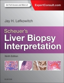 Image for Scheuer's Liver Biopsy Interpretation