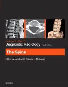 Image for Grainger & Allison's Diagnostic Radiology: The Spine