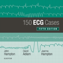 Image for 150 ECG Cases