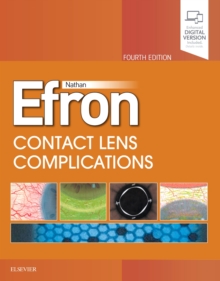 Image for Contact Lens  Complications