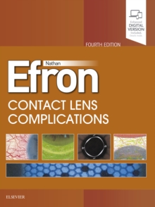 Image for Contact Lens Complications