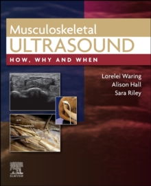 Musculoskeletal Ultrasound: How, Why and When