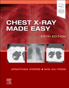 Image for Chest x-ray made easy