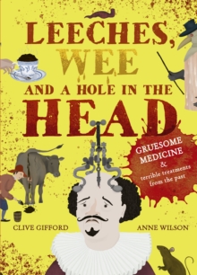 Image for Leeches, wee and a hole in the head  : gruesome medicine and terrible treatments from the past