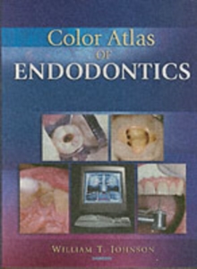 Image for Color Atlas of Endodontics