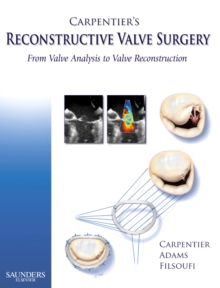 Image for Carpentier's reconstructive valve surgery