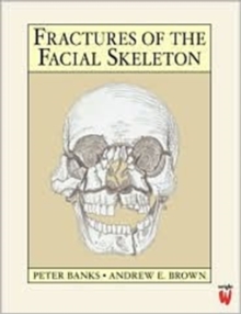 Image for Fractures of the Facial Skeleton
