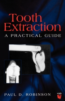 Image for Tooth Extraction