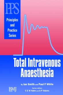 Image for Total Intravenous Anaesthesia
