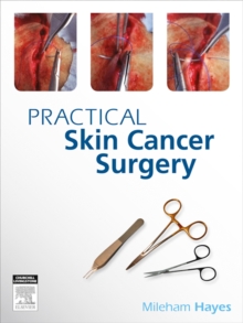 Image for PRACTICAL SKIN CANCER SURGERY