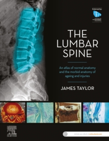 Image for Anatomy of the Lumbar Spine: An Atlas of Normal Anatomy and the Morbid Anatomy of Ageing and Injury