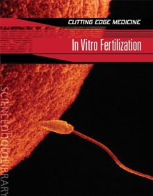 Image for In Vitro Fertilization