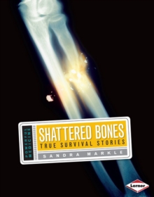 Image for Shattered Bones: True Survival Stories