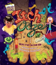 Image for Itch & Ooze: Gross Stuff On Your Skin