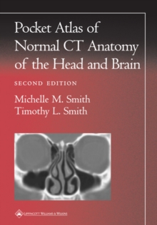 Image for Pocket Atlas of Normal CT Anatomy of the Head and Brain