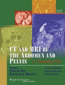 Image for CT and MRI of the Abdomen and Pelvis