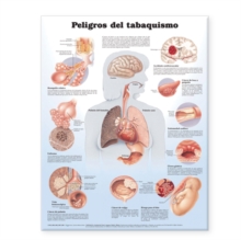 Image for Dangers of Smoking Anatomical Chart in Spanish (Peligros del tabaquismo)