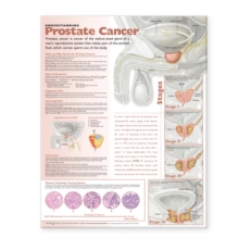 Image for Understanding Prostate Cancer Anatomical Chart
