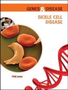 Image for Sickle Cell Disease