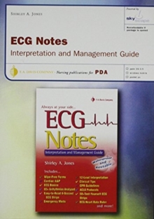 Image for ECG Notes for PDA, based on ECG Notes: Interpretation and Management Guide, powered by Skyscape (CD-ROM version)