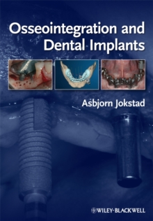 Image for Osseointegration and dental implants