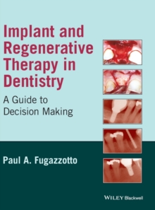 Image for Implant and Regenerative Therapy in Dentistry