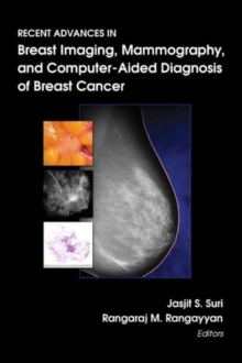 Image for Recent Advances in Breast Imaging, Mammography, and Computer-aided Diagnosis of Breast Cancer