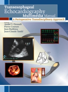 Image for Transesophageal Echocardiography Multimedia Manual, first edition