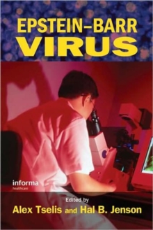 Image for Epstein-Barr Virus