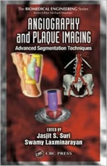 Image for Angiography and plaque imaging  : advanced segmentation techniques