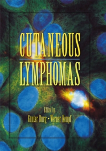 Image for Cutaneous lymphomas.
