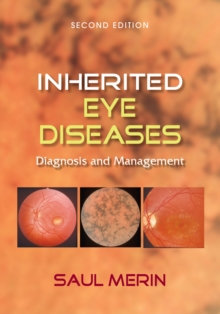 Image for Inherited eye diseases: diagnosis and management