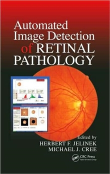 Automated Image Detection of Retinal Pathology