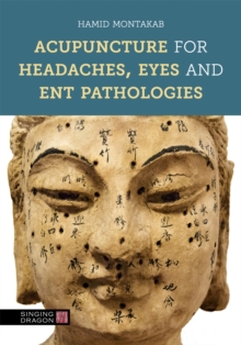 Acupuncture for Headaches, Eyes and ENT Pathologies