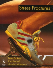 Image for Stress fractures