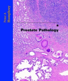 Image for Prostate Pathology