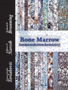 Bone Marrow Immunohistochemistry