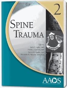 Image for Spine Trauma
