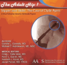 Image for The Adult Hip: Case 1 (Intertrochanteric Fracture) : Slippin' and Slidin': The Case of Clyde Ayers