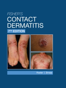 Image for Fisher's Contact Dermatitis - 7th Edition