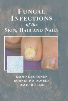 Image for Fungal Infections of the Skin and Nails