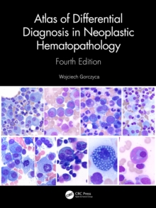 Image for Atlas of Differential Diagnosis in Neoplastic Hematopathology