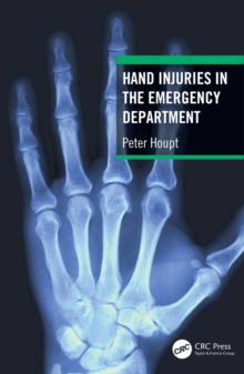Image for Hand injuries in the emergency department
