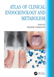 Image for Atlas of Clinical Endocrinology and Metabolism