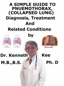 Image for Simple Guide to Pneumothorax (Collapsed Lungs), Diagnosis, Treatment and Related Conditions