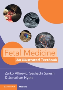 Image for Fetal Medicine
