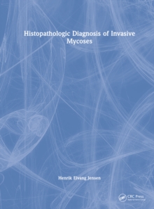 Histopathologic Diagnosis of Invasive Mycoses